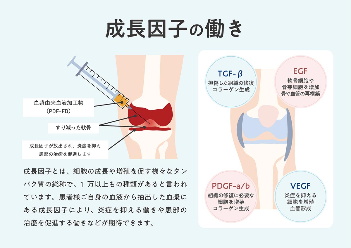 PDF-FD説明用3